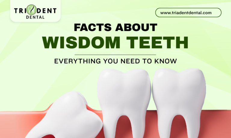 Facts About Wisdom Teeth: Everything You Need To Know