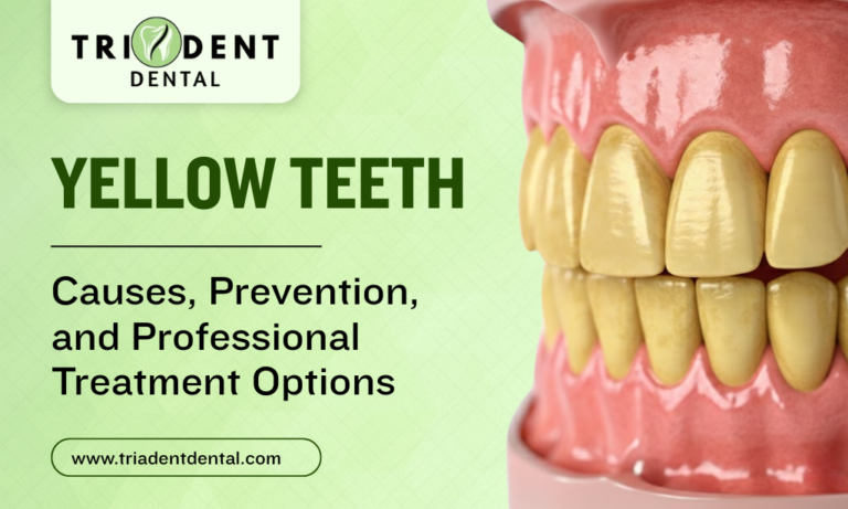 Yellow Teeth: Causes, Prevention, and Professional Treatment Options