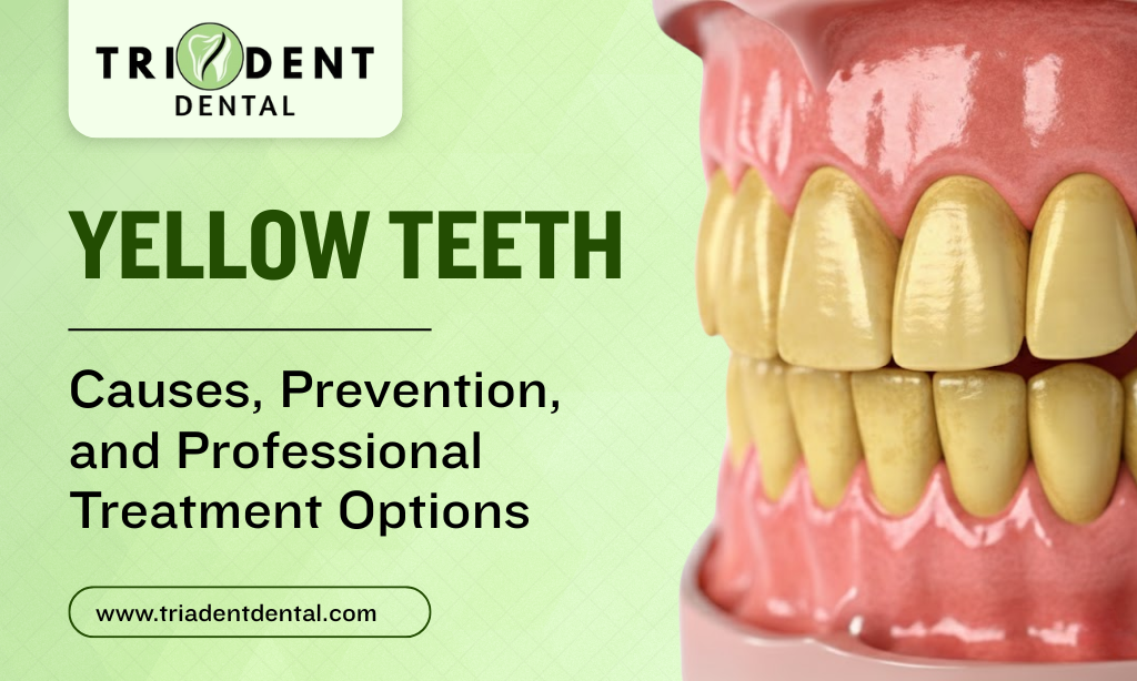 Yellow Teeth