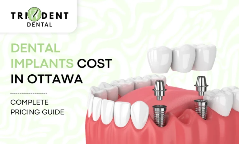 Dental Implants Cost In Ottawa: Complete Pricing Guide