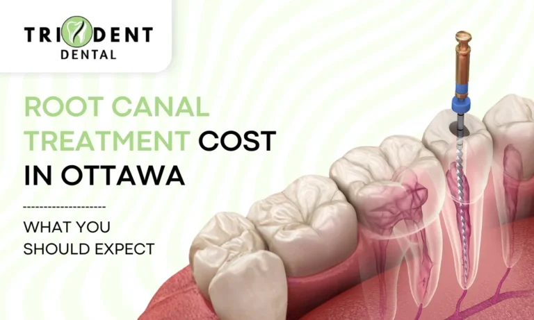 Root Canal Treatment Cost In Ottawa: What You Should Expect
