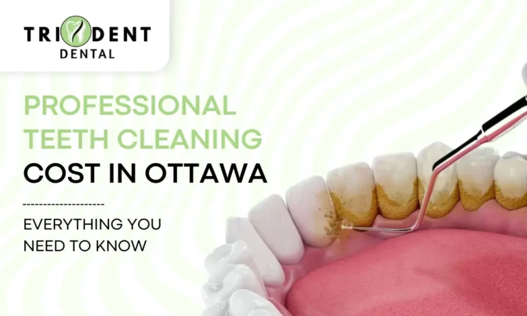 Professional Teeth Cleaning Cost In Ottawa: Everything You Need To Know