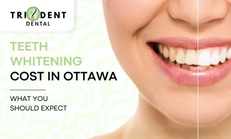 Teeth Whitening Cost In Ottawa: What You Should Expect