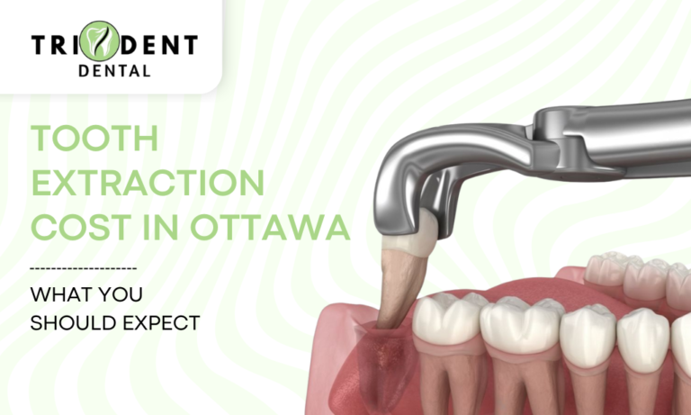 Tooth Extraction Cost In Ottawa: What You Should Expect