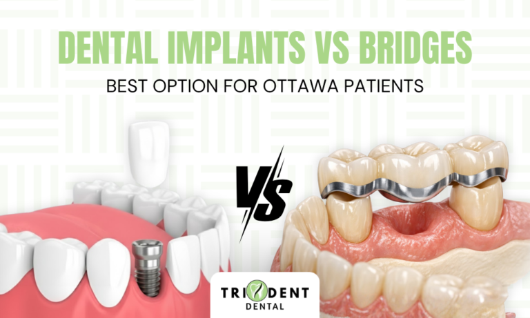 Dental Implants Vs Bridges: Best Option For Ottawa Patients