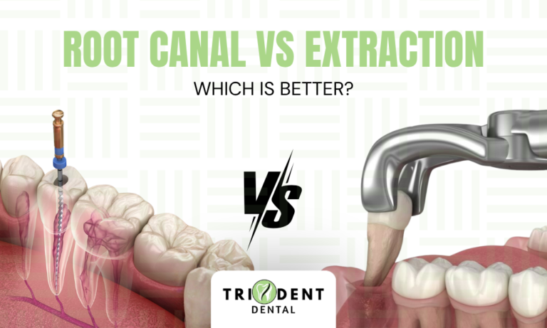 Root Canal vs Extraction: Which Is Better?