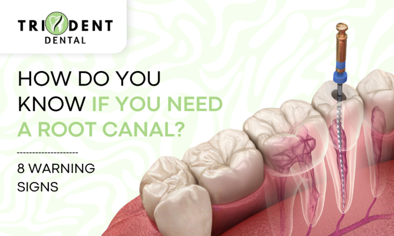 How Do You Know If You Need a Root Canal? 8 Warning Signs